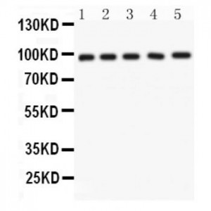 NUP98  Antibody