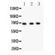 Nurr1  Antibody