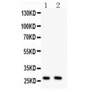 Olig1 Antibody