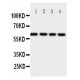 Osteoprotegerin Antibody