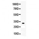 Otx2  Antibody