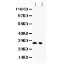 P27 KIP 1  Antibody