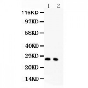 P27 KIP 1  Antibody