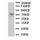 P2RX7 Antibody