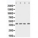 p53R2 Antibody