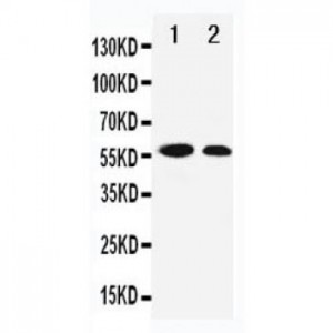 p57 Kip2 Antibody