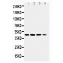 p75 NGF Receptor Antibody