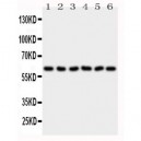 PAK1 Antibody