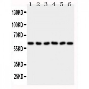 PAK1 Antibody