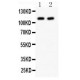 PARP Antibody