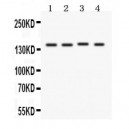 Patched/PTCH1  Antibody