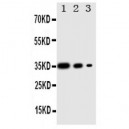 PERK Antibody