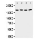 Phospholipase A2 Antibody