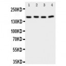 Phospholipase A2 Antibody