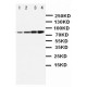 PI 3 Kinase p85 alpha Antibody