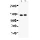 PIK3CA  Antibody