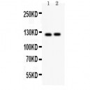 PIK3CA  Antibody