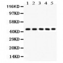 PIM1  Antibody