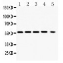 PKB alpha Antibody (monoclonal)