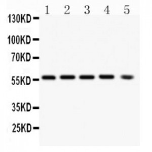 PKB alpha Antibody (monoclonal)