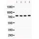 PKC alpha  Antibody