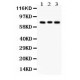 PKC beta 1  Antibody