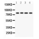 PKC eta  Antibody