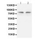 PKC gamma Antibody