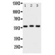 PKM2 Antibody