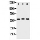 PKM2 Antibody