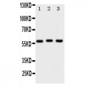 PKM2 Antibody