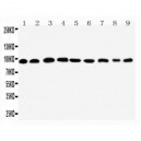 Plakophilin 2 Antibody