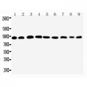 Plakophilin 2 Antibody