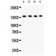 PLCB1  Antibody