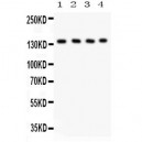 PLCB1  Antibody