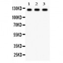 PLD1  Antibody