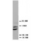 PLGF Antibody