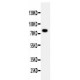 PPP1R15B Antibody