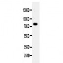 PPP1R15B Antibody