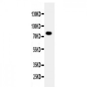 PPP1R15B Antibody