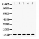 Profilin 1  Antibody