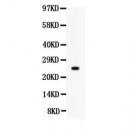 Prolactin  Antibody