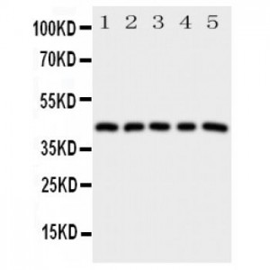 Prostaglandin E Receptor EP1 Antibody