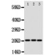 Prosurfactant Protein C Antibody