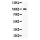 Prothrombin Antibody