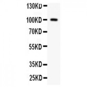 Prothrombin Antibody