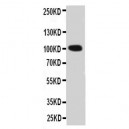 Prothrombin Antibody