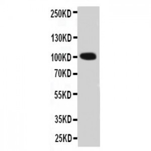 Prothrombin Antibody