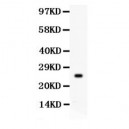 PSA  Antibody