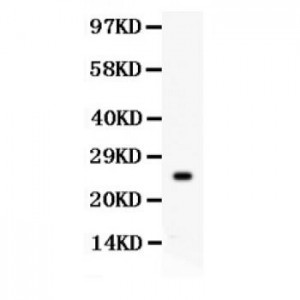 PSA Antibody - Novatein Biosciences